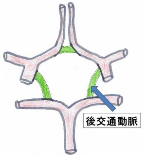 XCh11.JPG