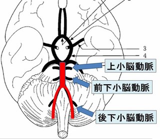 脳血管.jpg