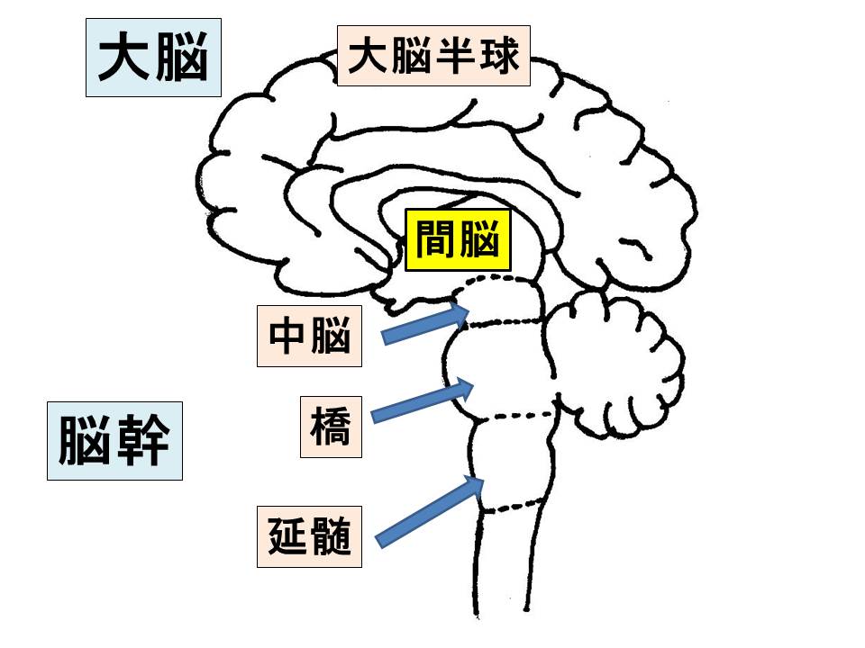 脳幹梗塞の治療法は何ですか?